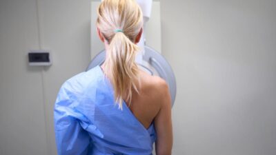 What to Expect, Cost and How to Prep